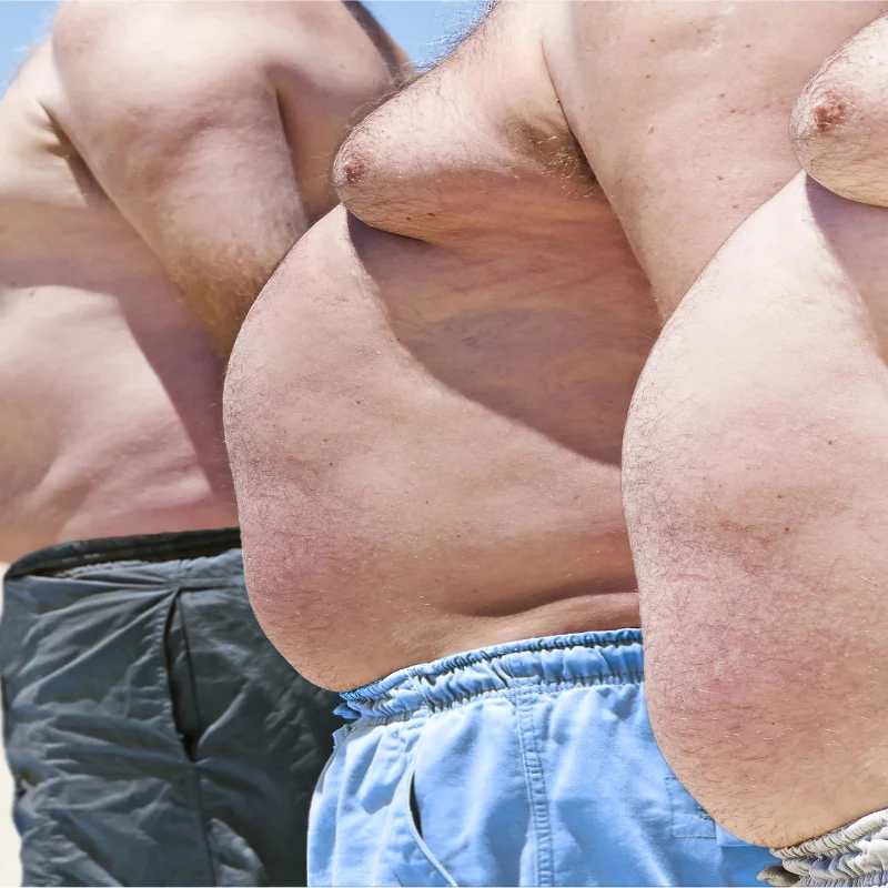 BMI stupnice s barevným rozlišením stupňů obezity